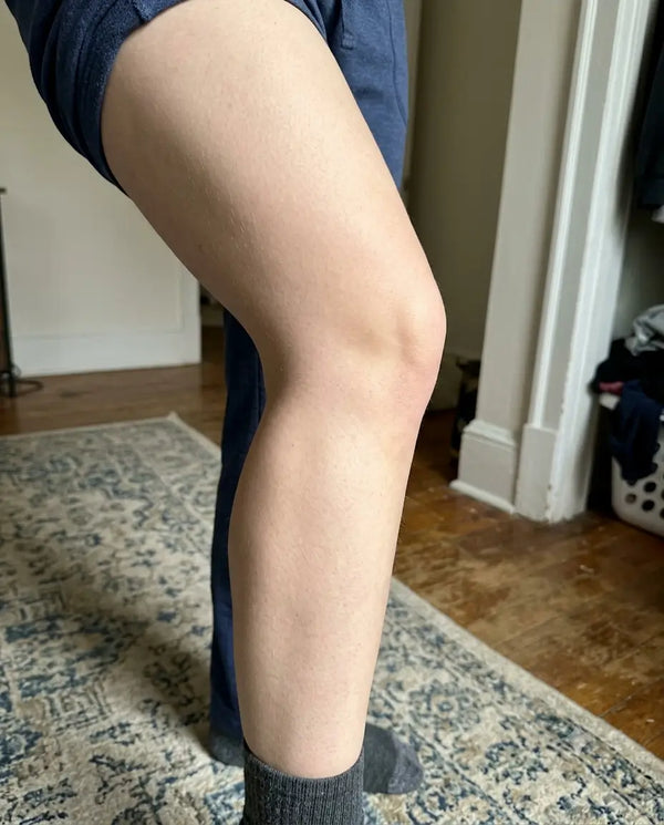 Hannah.skinjourney post