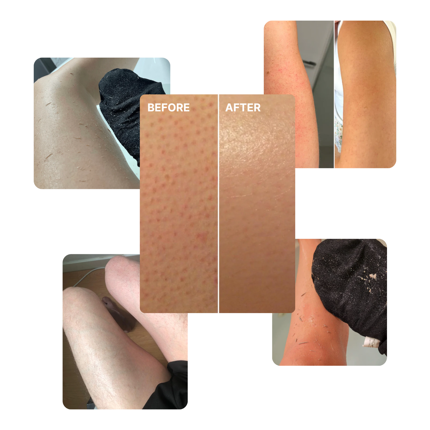 KERATOSIS PILARIS SMOOTHING CREAM (2000 x 2000 px) (6).png__PID:54dcaad8-6bc3-4f49-9c5c-a1e70c59f712