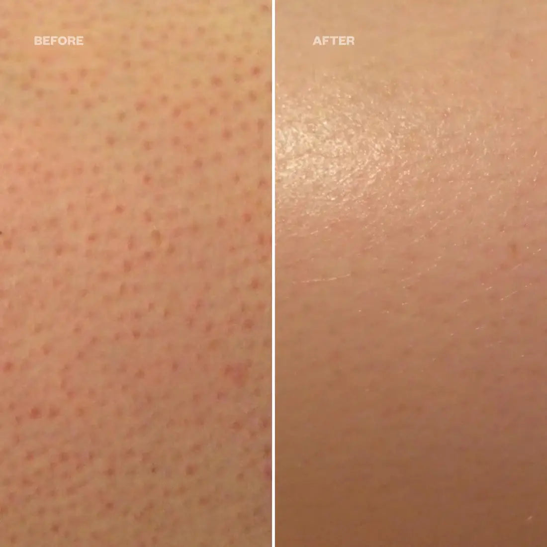KP Redness Soothing Cream