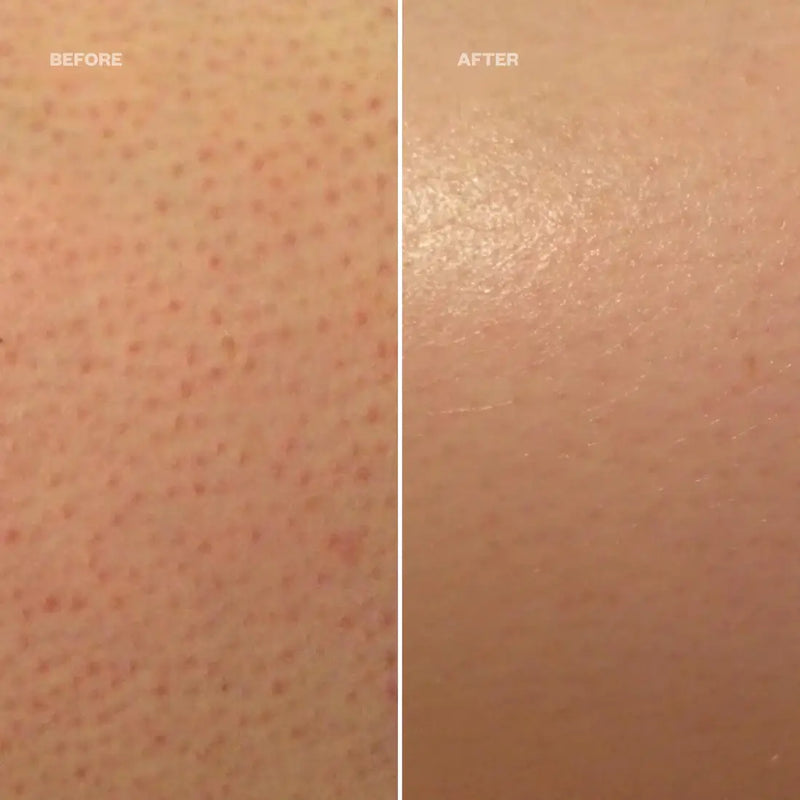 KP Redness Soothing Cream